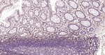 S100A4 Antibody in Immunohistochemistry (Paraffin) (IHC (P))