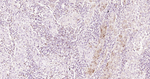 S100A4 Antibody in Immunohistochemistry (Paraffin) (IHC (P))