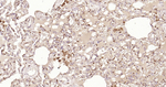 S100A4 Antibody in Immunohistochemistry (Paraffin) (IHC (P))