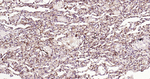 S100A4 Antibody in Immunohistochemistry (Paraffin) (IHC (P))