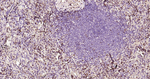 S100A4 Antibody in Immunohistochemistry (Paraffin) (IHC (P))