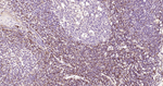 S100A4 Antibody in Immunohistochemistry (Paraffin) (IHC (P))