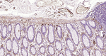 Caldesmon Antibody in Immunohistochemistry (Paraffin) (IHC (P))
