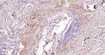 Caldesmon Antibody in Immunohistochemistry (Paraffin) (IHC (P))