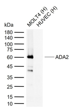 CECR1 Recombinant Rabbit Monoclonal Antibody (9A3)