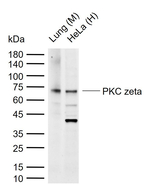 PKC zeta Recombinant Rabbit Monoclonal Antibody (7H17)