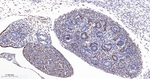 WT1 Antibody in Immunohistochemistry (Paraffin) (IHC (P))