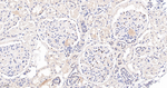 WT1 Antibody in Immunohistochemistry (Paraffin) (IHC (P))