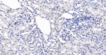 WT1 Antibody in Immunohistochemistry (Paraffin) (IHC (P))