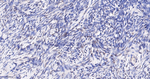 WT1 Antibody in Immunohistochemistry (Paraffin) (IHC (P))