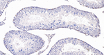 WT1 Antibody in Immunohistochemistry (Paraffin) (IHC (P))