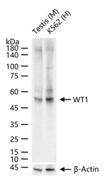 WT1 Antibody in Western Blot (WB)