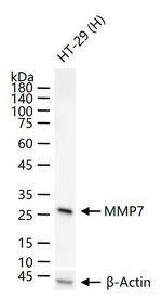 MMP7 Antibody in Western Blot (WB)
