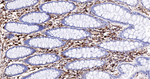 ALOX15 Antibody in Immunohistochemistry (Paraffin) (IHC (P))