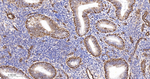 ALOX15 Antibody in Immunohistochemistry (Paraffin) (IHC (P))