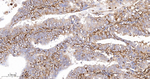 ALOX15 Recombinant Rabbit Monoclonal Antibody (11G5)