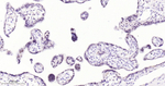 ATF3 Recombinant Rabbit Monoclonal Antibody (3G6)