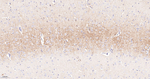 SSEA1 Antibody in Immunohistochemistry (Paraffin) (IHC (P))