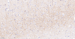 SSEA1 Antibody in Immunohistochemistry (Paraffin) (IHC (P))