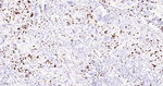 SSEA1 Antibody in Immunohistochemistry (Paraffin) (IHC (P))