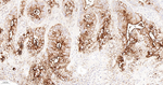 SSEA1 Antibody in Immunohistochemistry (Paraffin) (IHC (P))