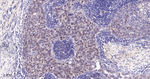 PARP1 (cleaved p25) Antibody in Immunohistochemistry (Paraffin) (IHC (P))