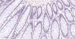 PARP1 (cleaved p25) Antibody in Immunohistochemistry (Paraffin) (IHC (P))