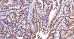 PARP1 (cleaved p25) Antibody in Immunohistochemistry (Paraffin) (IHC (P))