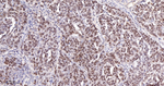PARP1 (cleaved p25) Recombinant Rabbit Monoclonal Antibody (9B10)