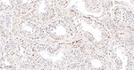 PARP1 (cleaved p25) Antibody in Immunohistochemistry (Paraffin) (IHC (P))