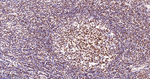 PARP1 (cleaved p25) Antibody in Immunohistochemistry (Paraffin) (IHC (P))