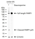 PARP1 (cleaved p25) Antibody in Western Blot (WB)