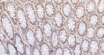 Phospho-S6 (Ser235, Ser236) Antibody in Immunohistochemistry (Paraffin) (IHC (P))