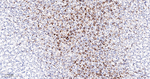 Phospho-S6 (Ser240, Ser244) Antibody in Immunohistochemistry (Paraffin) (IHC (P))