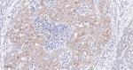 Phospho-S6 (Ser240, Ser244) Antibody in Immunohistochemistry (Paraffin) (IHC (P))