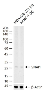 SNAIL Recombinant Rabbit Monoclonal Antibody (7B5)