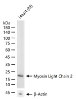 MYL2 Antibody in Western Blot (WB)