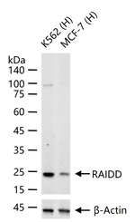 RAIDD Antibody in Western Blot (WB)