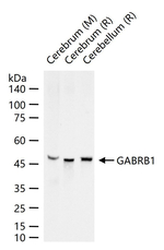 GABRB1 Recombinant Rabbit Monoclonal Antibody (5H8)