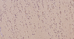 GPI Antibody in Immunohistochemistry (Paraffin) (IHC (P))