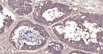 GPI Antibody in Immunohistochemistry (Paraffin) (IHC (P))