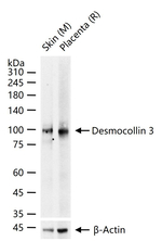 Desmocollin 3 Recombinant Rabbit Monoclonal Antibody (15H3)