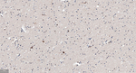 GABARAP Recombinant Rabbit Monoclonal Antibody (13C1)
