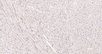 Dystrophin Antibody in Immunohistochemistry (Paraffin) (IHC (P))
