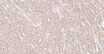 Dystrophin Antibody in Immunohistochemistry (Paraffin) (IHC (P))