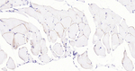 Dystrophin Recombinant Rabbit Monoclonal Antibody (8C6)