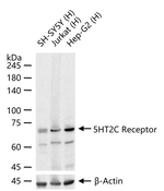 HTR2C Recombinant Rabbit Monoclonal Antibody (7D11)