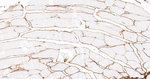 Collagen VI Antibody in Immunohistochemistry (Paraffin) (IHC (P))