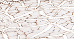 Collagen VI Antibody in Immunohistochemistry (Paraffin) (IHC (P))