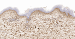 Collagen VI Antibody in Immunohistochemistry (Paraffin) (IHC (P))
